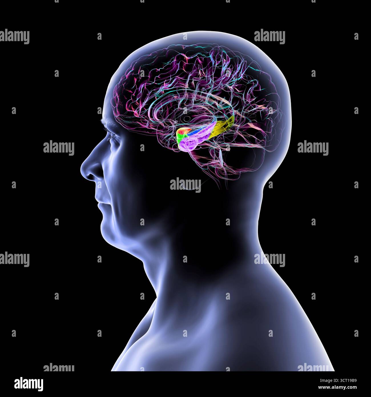 Abbildung eines menschlichen Hirnmittelschnitts mit hervorgehobener Amygdala (rot), Hippocampus (blau), parahippocampalem Gyrus und assoziierten Kortizen: Perirhinal (grün), entorhinal (violett) und parahippocampal (gelb). Stockfoto