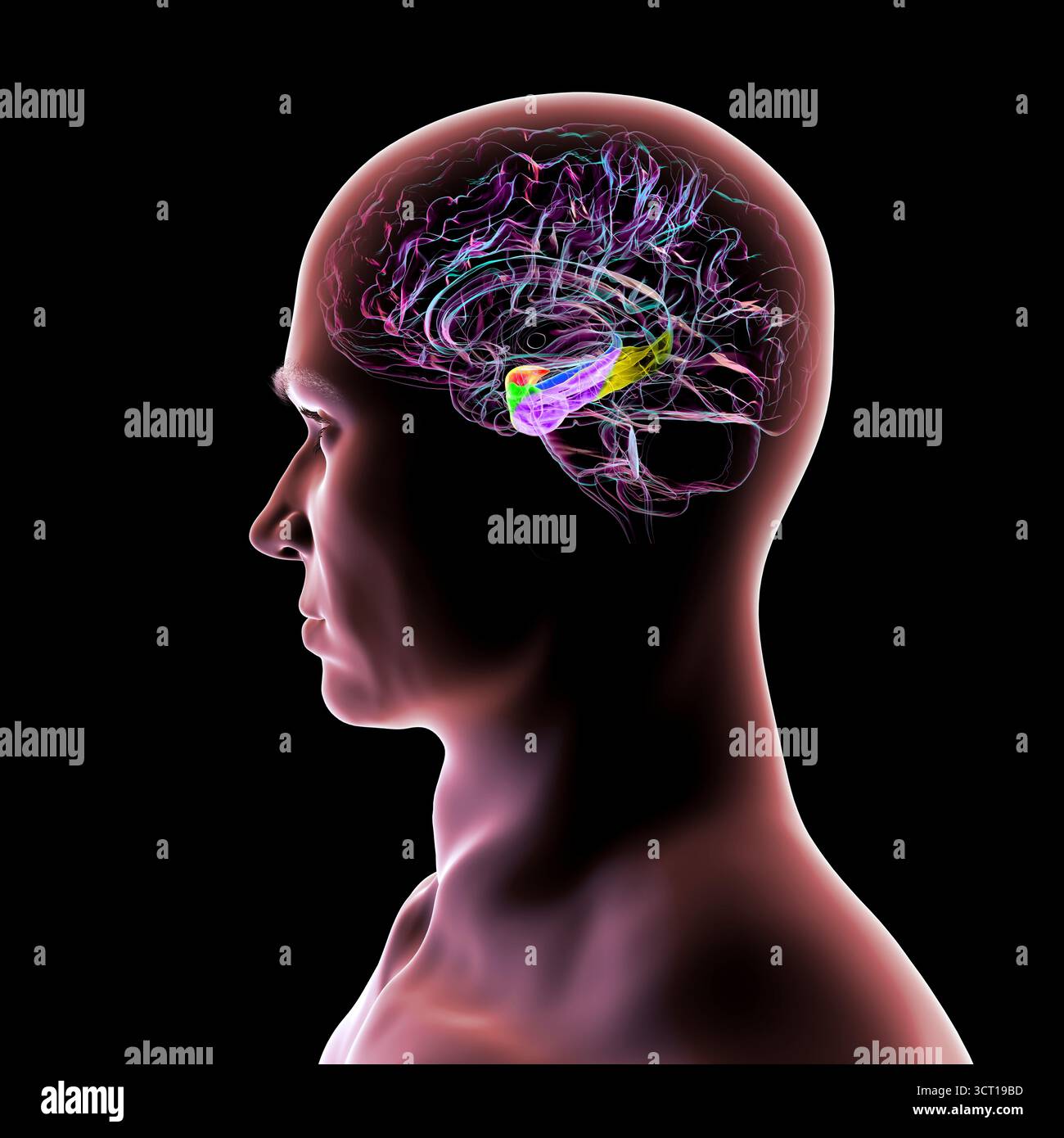 Abbildung eines menschlichen Hirnmittelschnitts mit hervorgehobener Amygdala (rot), Hippocampus (blau), parahippocampalem Gyrus und assoziierten Kortizen: Perirhinal (grün), entorhinal (violett) und parahippocampal (gelb). Stockfoto