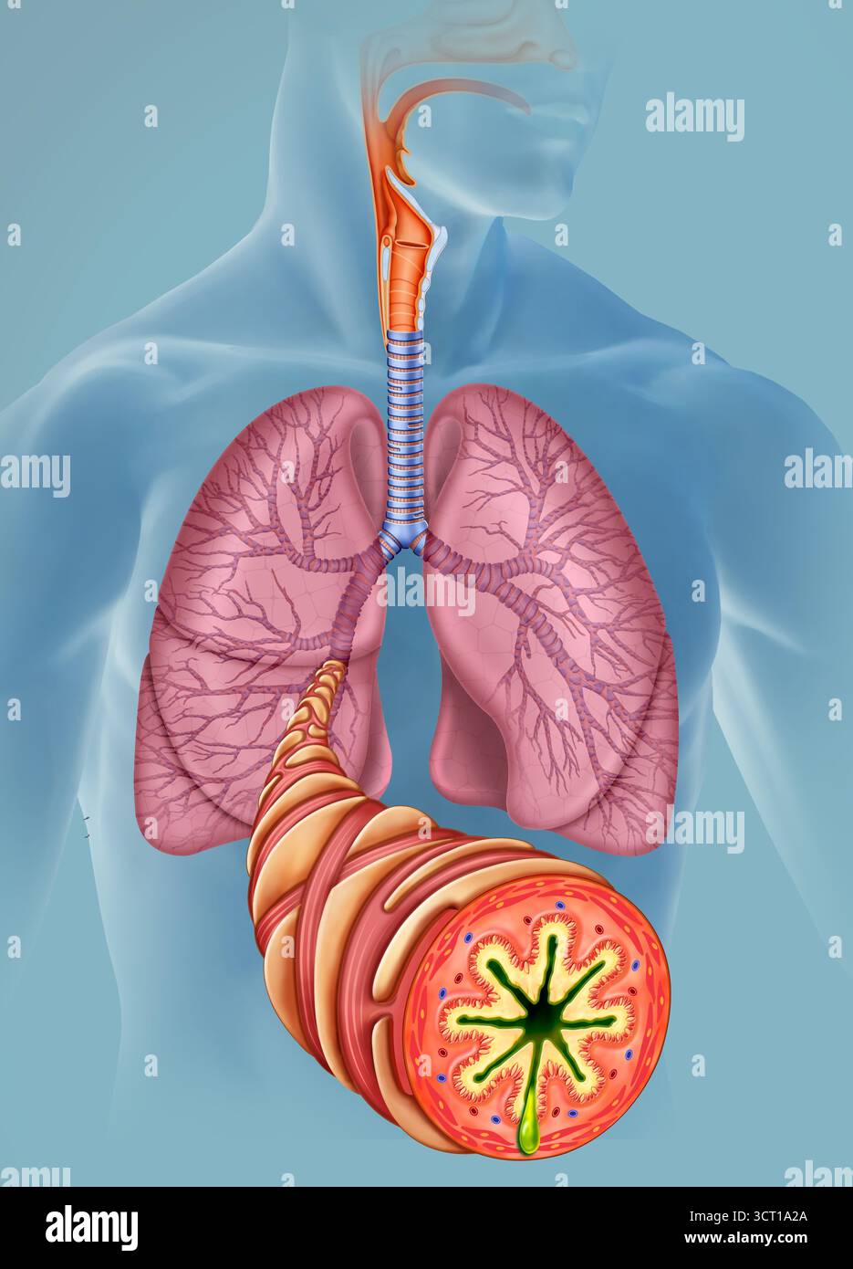 Abbildung einer menschlichen Figur mit asthmatischen Atemwegen, mit einem asthmatischen Bronchus im Vordergrund. Asthma ist eine chronische Erkrankung, die durch Entzündung und Verengung der Bronchien gekennzeichnet ist, was Atembeschwerden, Keuchen und Husten verursacht. Stockfoto