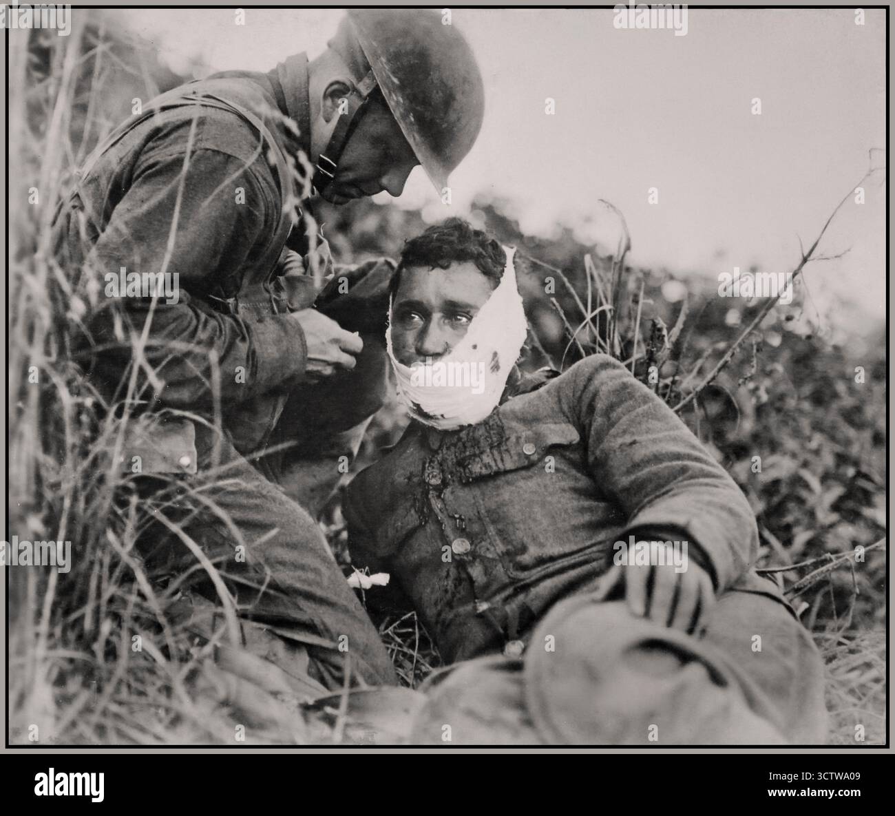 ARGONNE verwundete Soldat mit Gesichtsverband der Kompanie K, 110. Regiment Infanterie (ehemals 3. Und 10. Infanterie, Pennsylvania National Guard), gerade verletzt, mit Angst in den Augen, erhielt erste Hilfe von einem Kameraden. Varennes-en-Argonne, Frankreich., 09/26/1918 Stockfoto