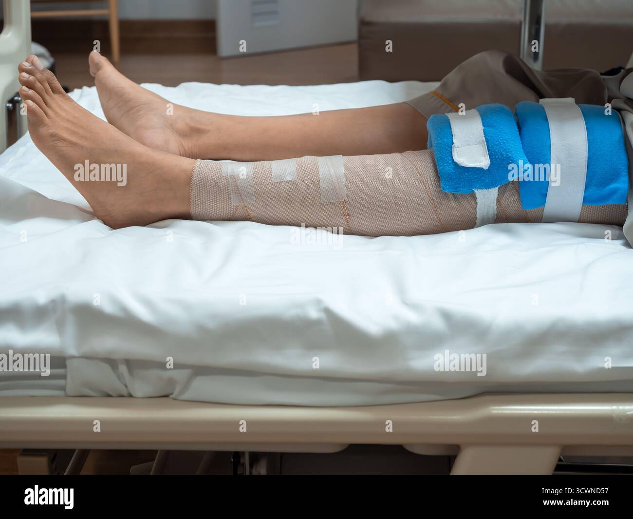 Patient liegend im Krankenhausbett mit bandagiertem Knie und Cold Pack nach ACL- und Meniskusoperationen. Konzept der postoperativen Erholung, orthopädischen Verletzung, Re Stockfoto