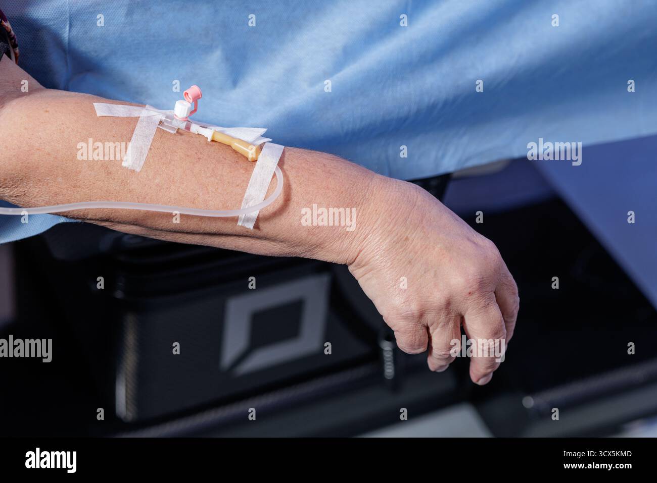 Closeup periphere IV-Kanüle mit Klebeband auf einem Patientenarm mit Schlauch für Infusionstherapie in der Krankenhausversorgung, ideal für chirurgische Vorbereitung, Erholung und Pflege Stockfoto