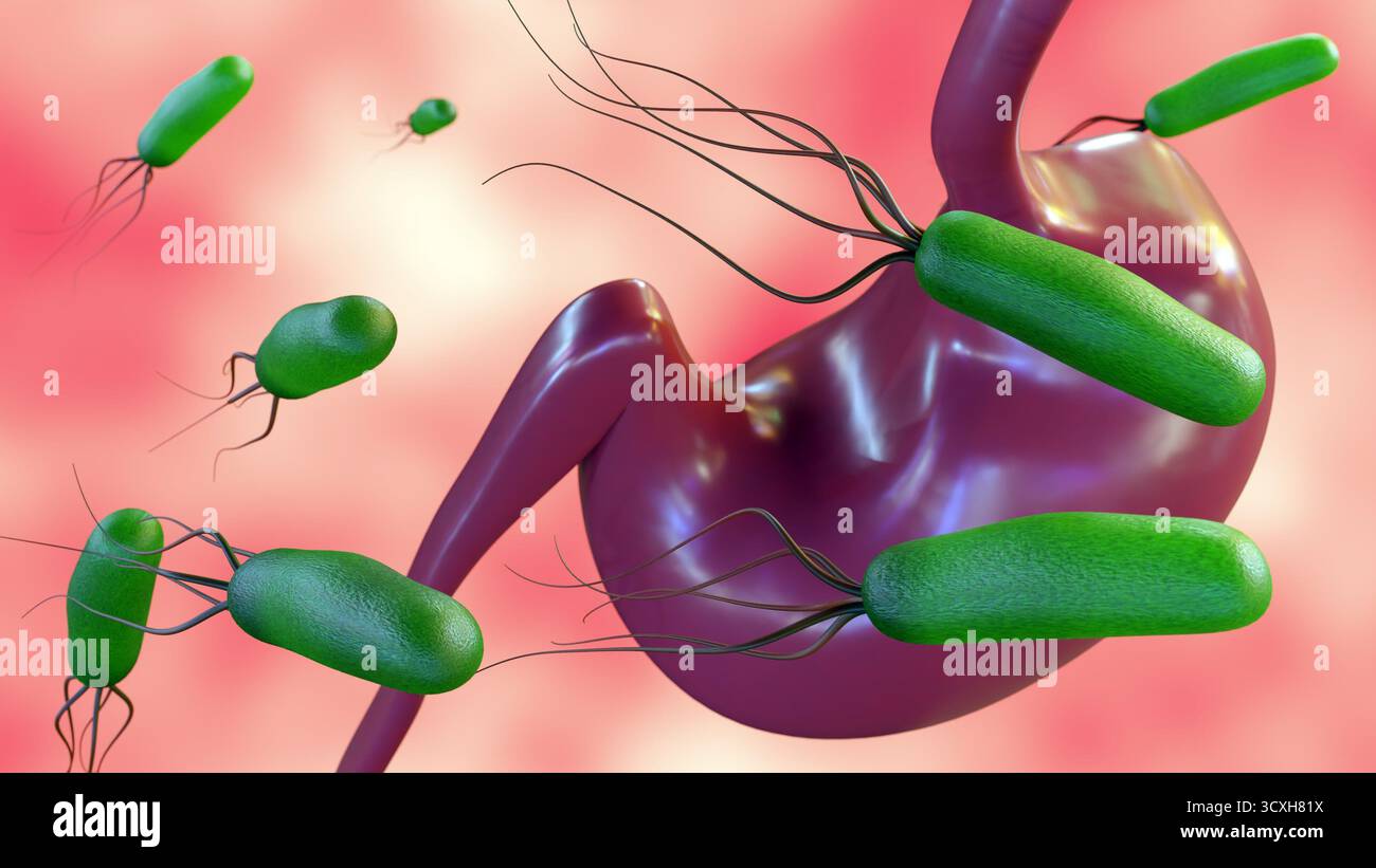 Eine 3D-Visualisierung betont die bakterielle HELICOBACTER PYLORI-Infektion im Magen. Primäre Ursache gastrointestinaler Erkrankungen. Stockfoto