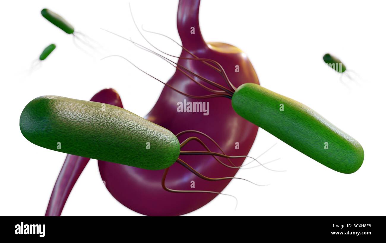 Eine 3D-Visualisierung betont die bakterielle HELICOBACTER PYLORI-Infektion im Magen. Primäre Ursache gastrointestinaler Erkrankungen. Stockfoto