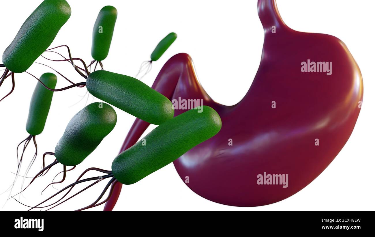 Eine 3D-Visualisierung betont die bakterielle HELICOBACTER PYLORI-Infektion im Magen. Primäre Ursache gastrointestinaler Erkrankungen. Stockfoto