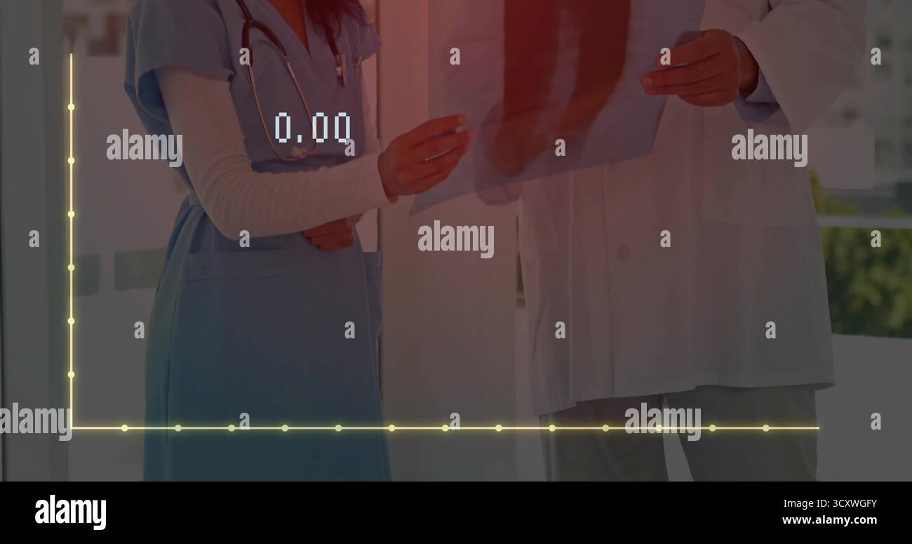 Stethoskope tragen, Mediziner überprüfen Thoraxröntgenfilm in der Krankenhaushalle, mit digitaler Graphen-Überlagerung Stockfoto