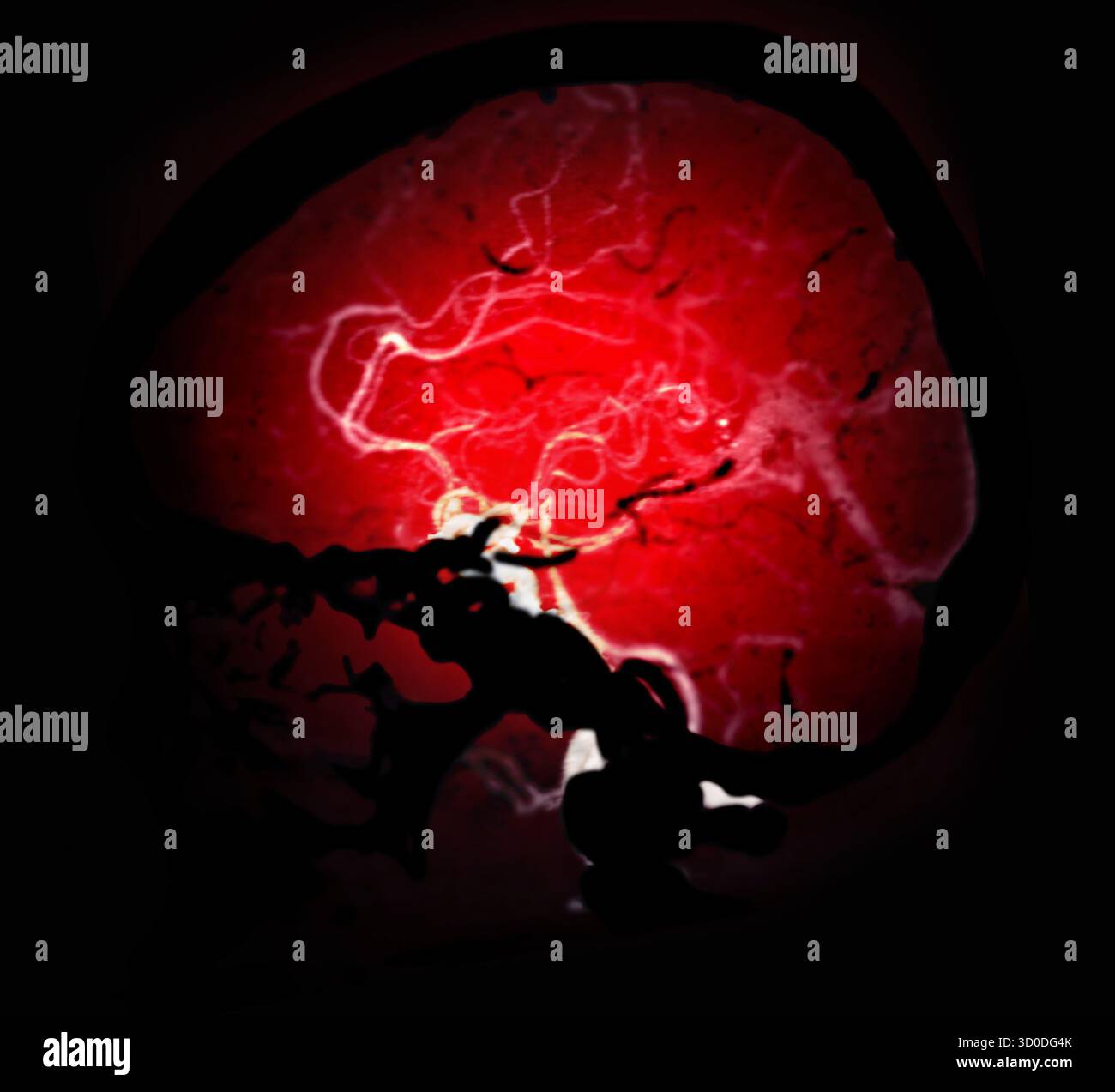 CTA Brain Vascular Imaging , Eine atemberaubende Darstellung des Gefäßsystems des Gehirns, rot beleuchtet, bietet einen Einblick in den Vitalkreislauf Stockfoto