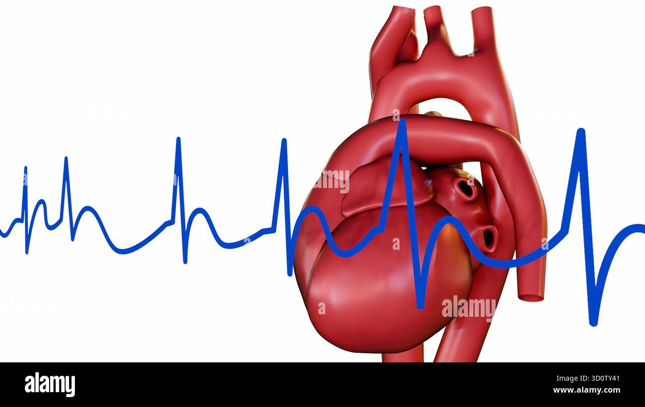 Eine 3D-Darstellung des menschlichen Herzens und des Pulses, die den Zustand der Arrythmie visualisiert. Stockfoto