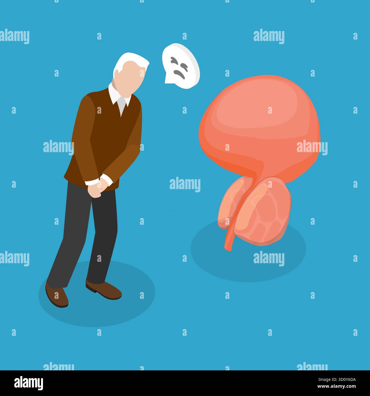 3D-Isometrische Flachdarstellung der vergrößerten Prostata, Probleme des männlichen Reproduktionssystems Stockfoto