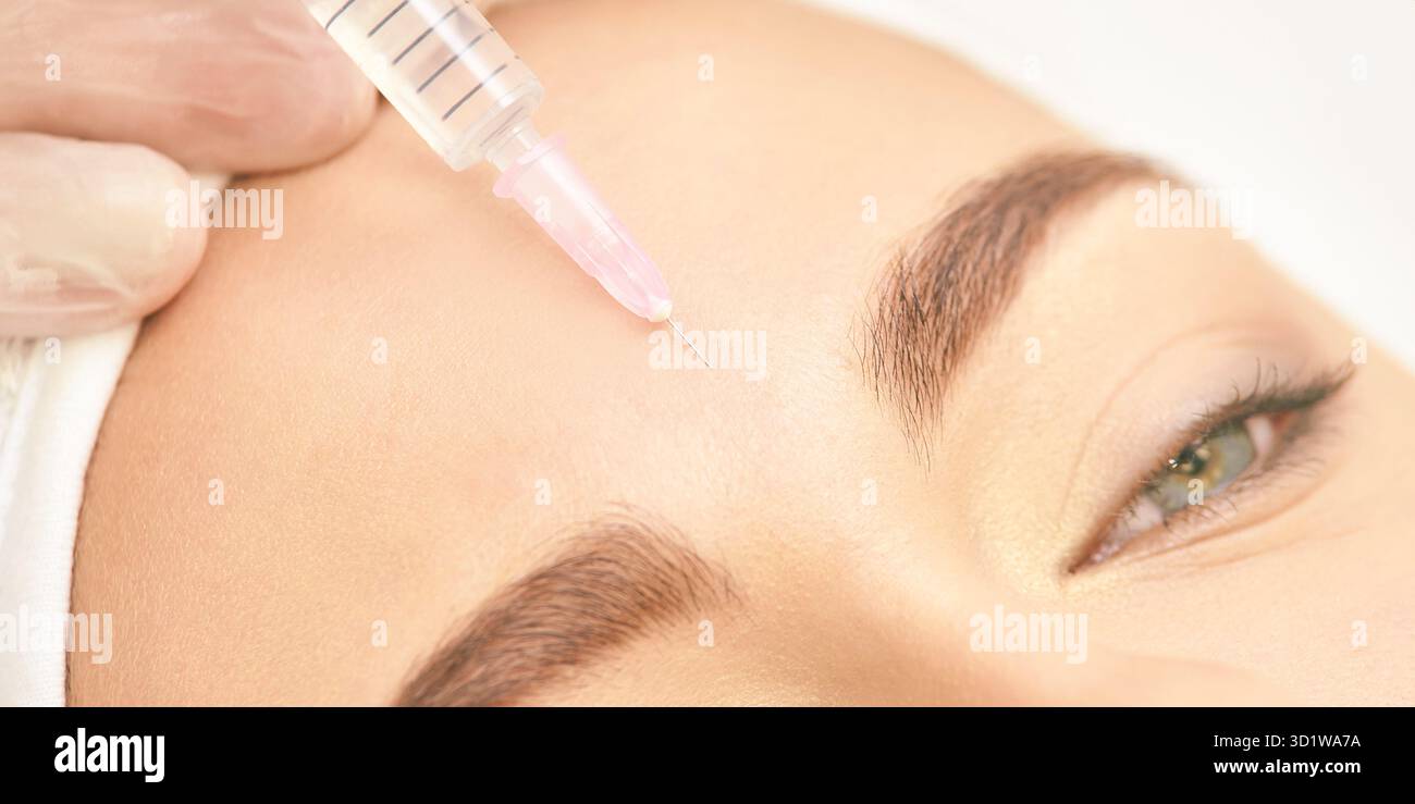 Operation der Stirn bei Frauen. Faltenschutz. Injektion der Kosmetologie. Gesicht Stockfoto