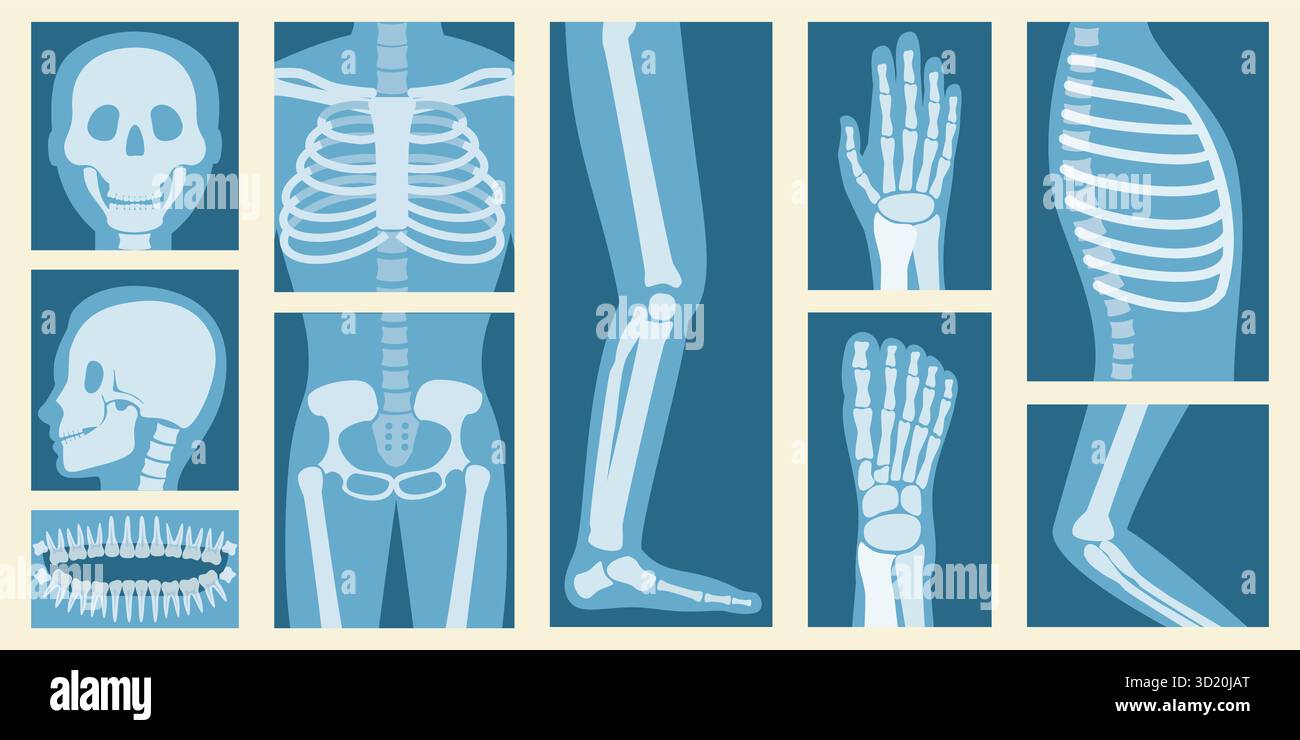 3D Isometrischer flacher Satz Röntgenstrahlen von menschlichen Körperteilen, Skelett und Knochen Scan3D Isometrischer flacher Satz Röntgenstrahlen von menschlichen Körperteilen, S Stockfoto