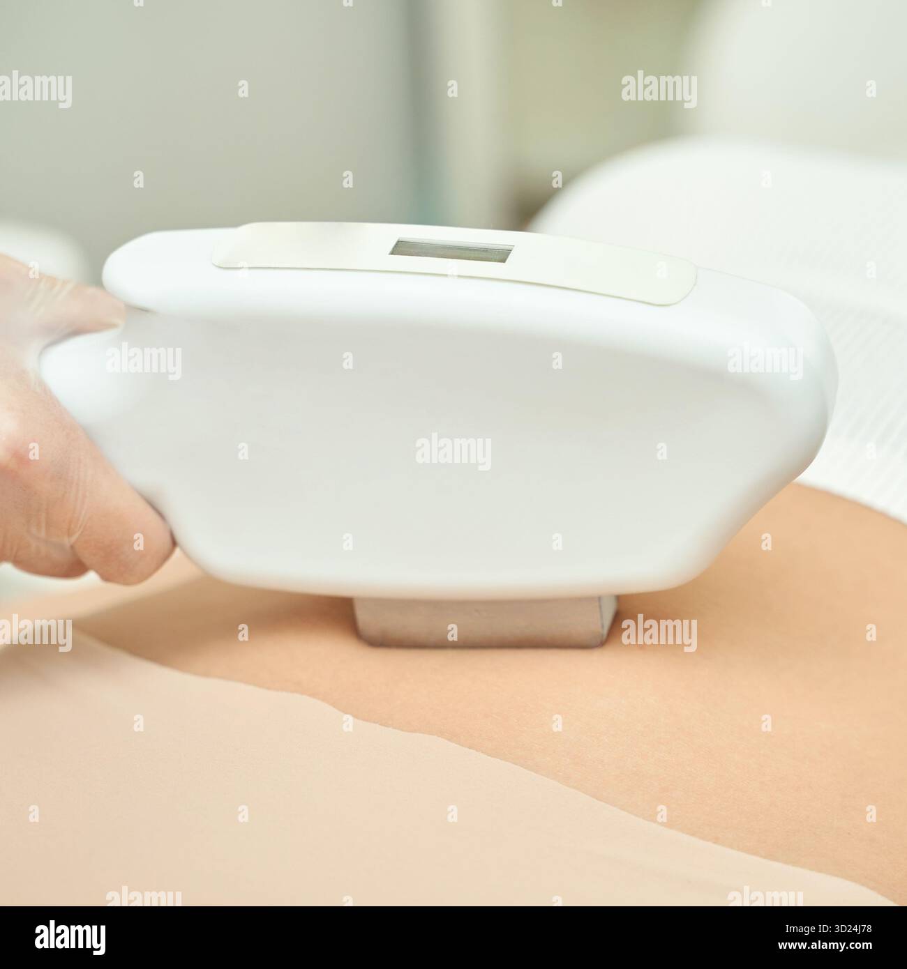Frau, die sich nicht-invasiver Körperkonturierung mit moderner Lasertechnologie unterzieht Stockfoto