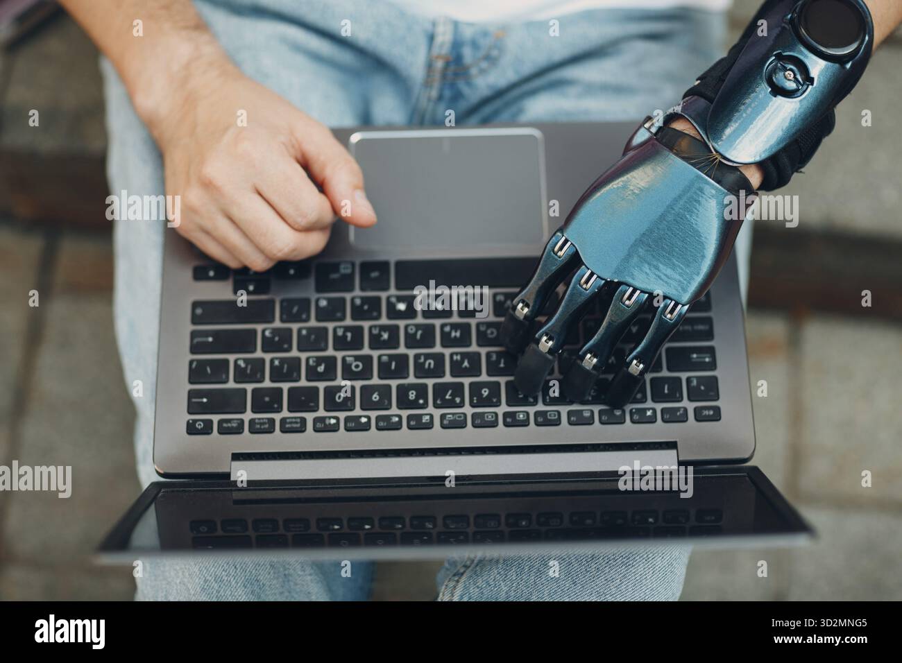 Junger behinderter Mann mit künstlicher prothetischer Hand mit der Eingabe auf Laptop-Computer Tastatur Tasten Tap Push Stockfoto