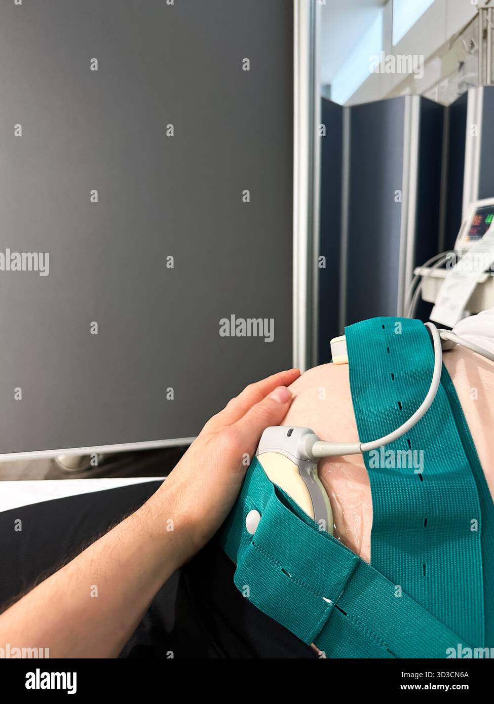 Schwangere Frau mit fetaler Überwachung während der Krankenhausuntersuchung Stockfoto