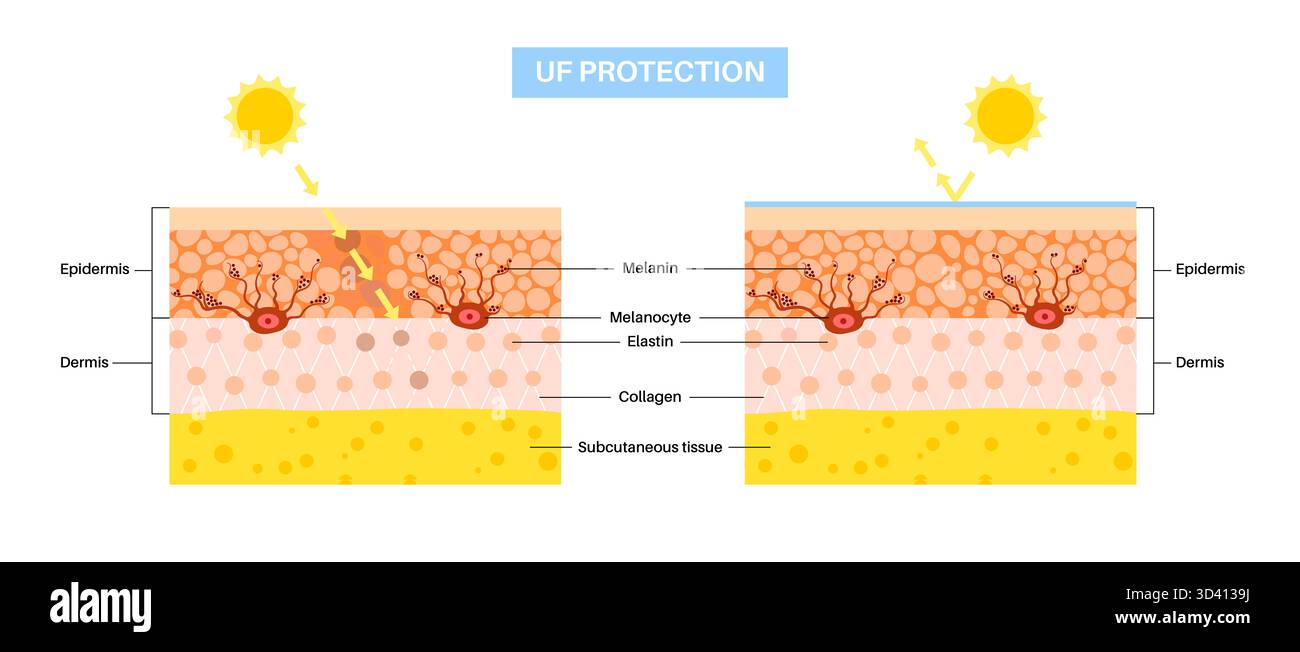 Illustration des UV-Schutzes der Haut. Sonnenschutzmittel schützt die Haut vor schädlicher UV-Strahlung durch die Verwendung von Mineralblockern, die UV-Strahlen reflektieren und streuen. Stockfoto