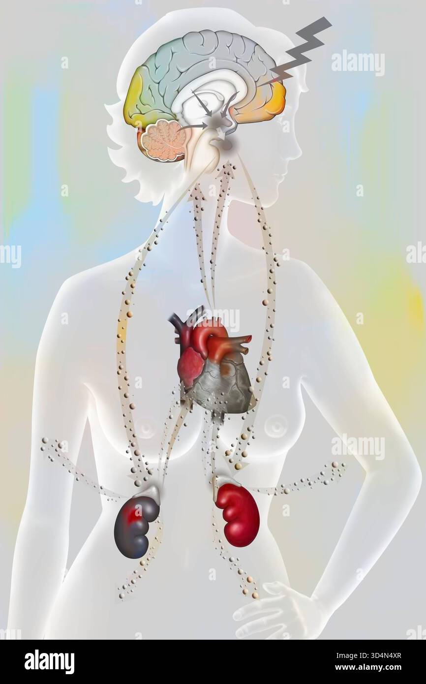 Die Auswirkungen der Belastung auf den Körper - die Widerstandsphase. Bei körperlichem oder psychologischem Stress reagiert der Körper in drei Phasen: Der Alarm Stockfoto