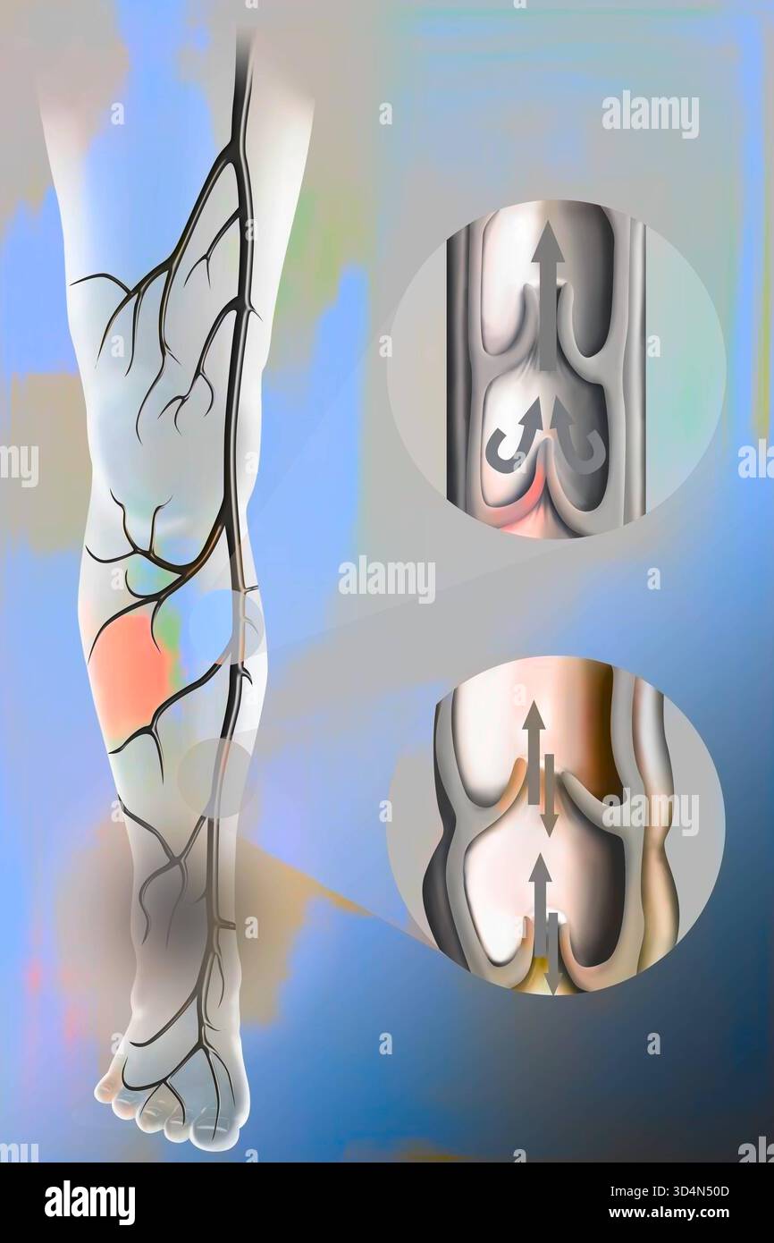 Venöser Reflux. Venen sorgen für die Rückkehr von sauerstoffarmem Blut zum Herzen. Viele Venen, insbesondere die in den Gliedmaßen, haben Venenklappen, Falten in t Stockfoto