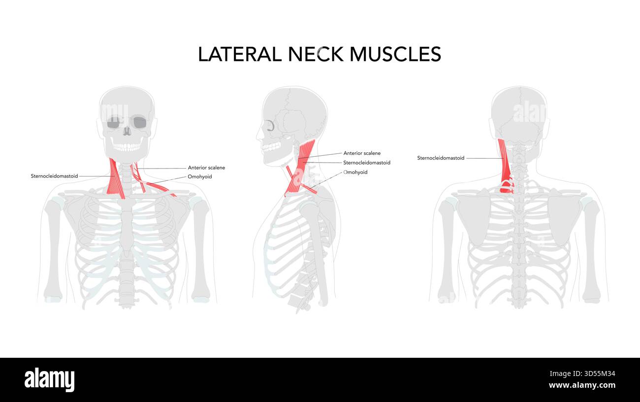 Laterale Halsmuskeln – Gruppe von Muskeln an den Seiten des Halses, einschließlich der vorderen, mittleren und hinteren Skalenmuskulatur, Levator scapulae, Splenius capitis. Stock Vektor
