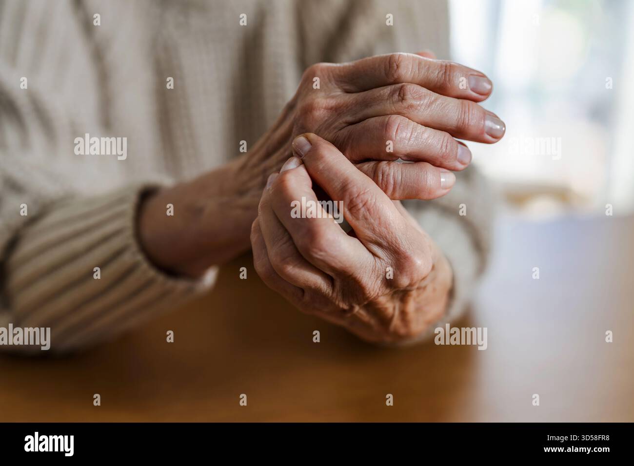 Ältere Frau mit reibenden Händen der Arthritis Stockfoto