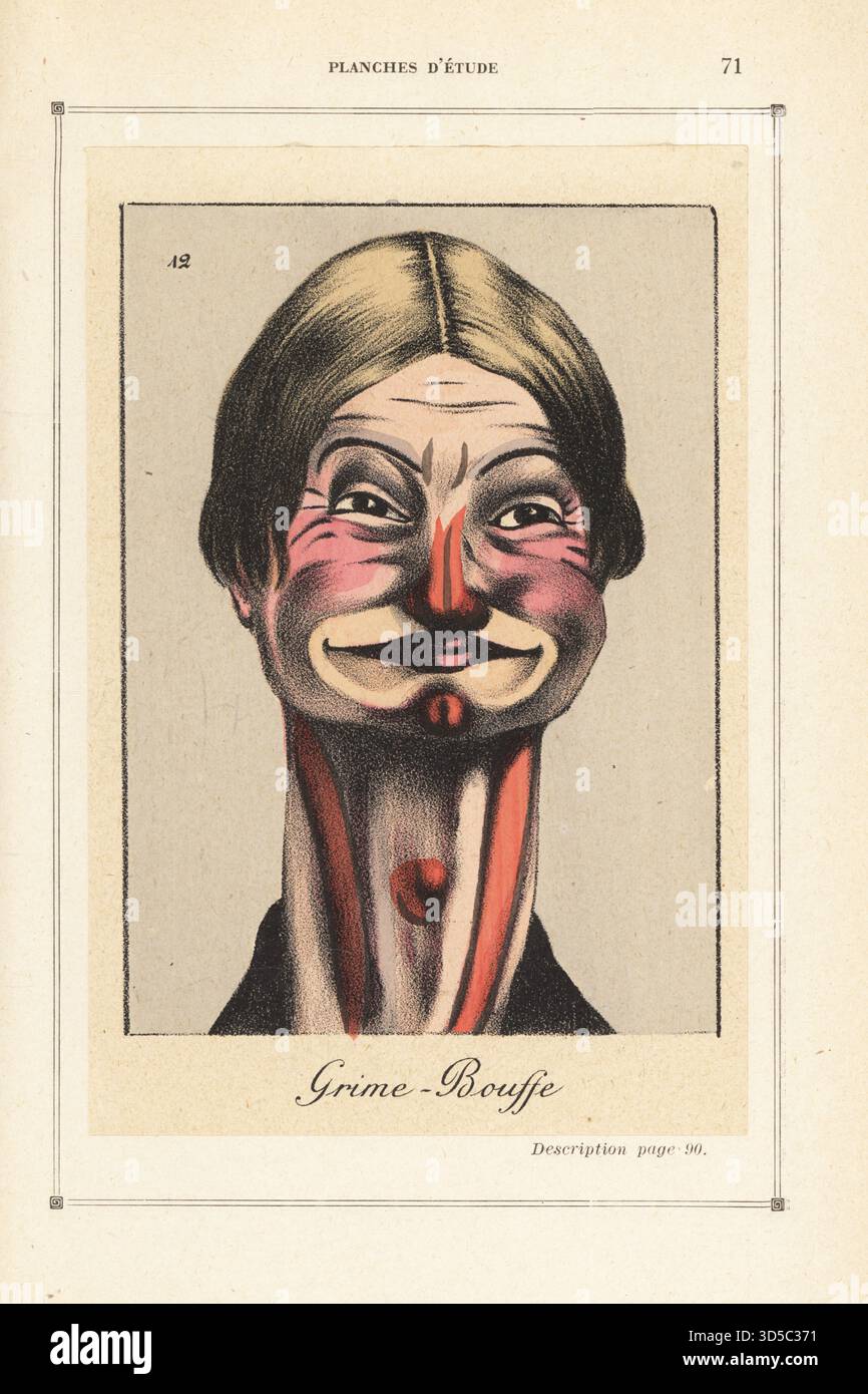 Theatralisches Make-up für den exzentrischen Comic Max-Hardine. Gesicht bedeckt mit fleischfarbenem Nr.3 Fundament, Nase mit Karmin gesprenkelt, mit Violett gefüttert, Ochsenblutwangen, Karminkinn, Nackenmuskeln mit Karmin gemalt, blau definiert. Augenfalten und Lippen mit Ockerblut, alle mit Ocker gepudert. Perücke, die vom Theaterwigmacher Mr. Chanteau zur Verfügung gestellt wurde. Grime-Bouffe. Chromolithographie aus Alfred Bitterlins L’Art du Maquillage, Art of Makeup, Editions Ulysse Boucoiran, Paris, 1925. Stockfoto