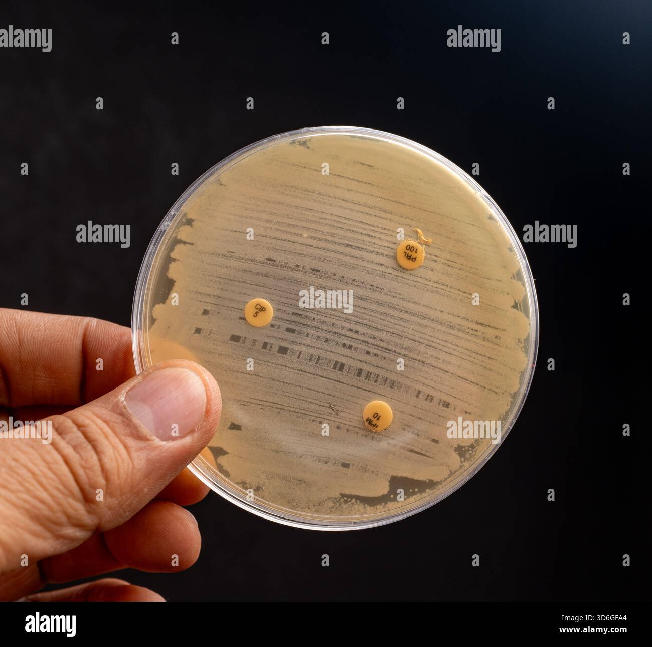 Die Hand hält eine Petrischale mit Bakterienkultur und antibiotischen Discs. Stockfoto