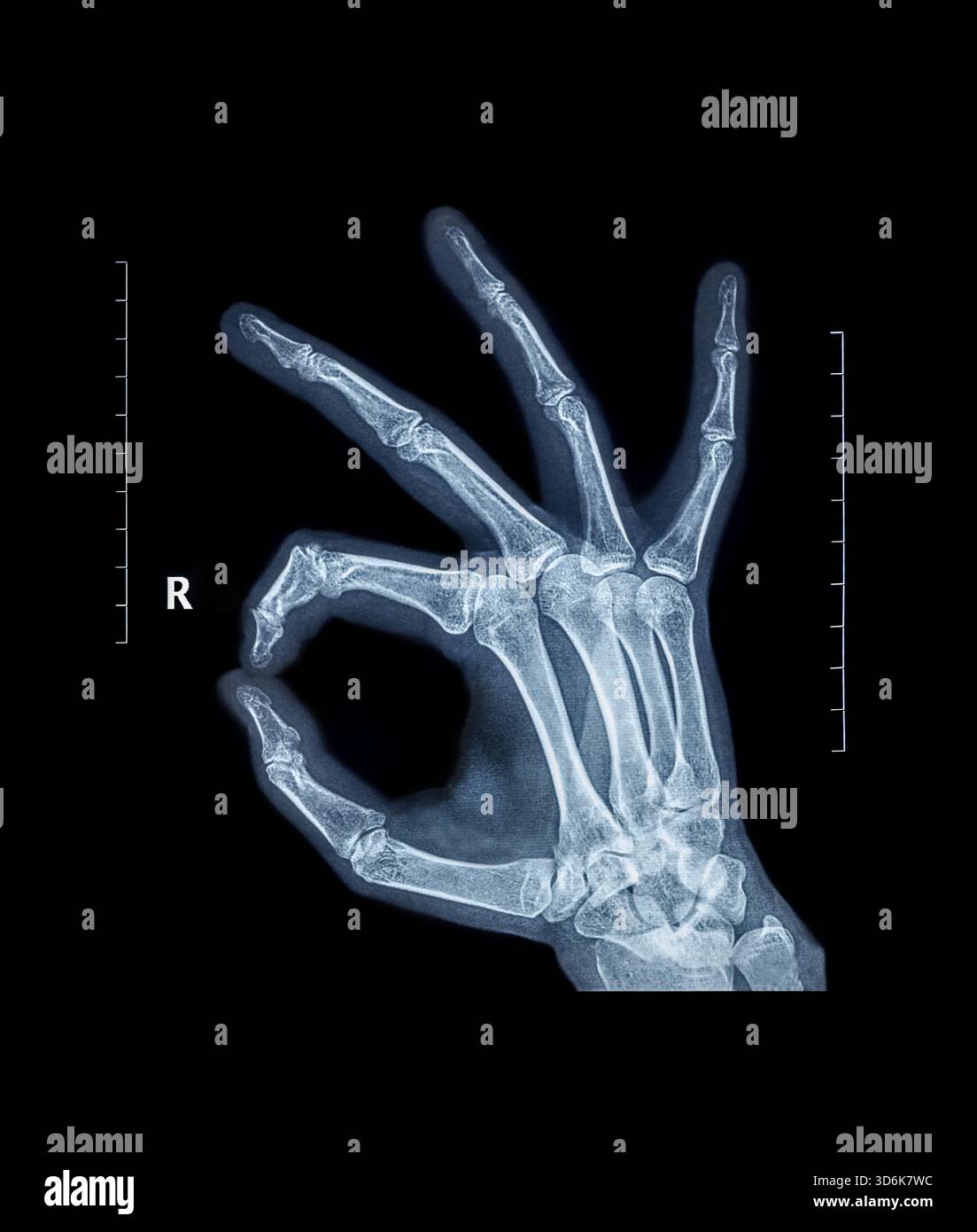 Röntgenologische Handknochen OK-Ringgeste, die Daumen und Zeigefinger im Kreis als Symbol der inneren Vollkommenheit verbindet Stockfoto