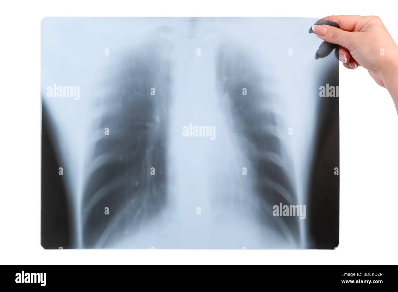 Bei einer weiblichen Hand Röntgenaufnahme der Lunge isoliert auf weißem Hintergrund. Stockfoto