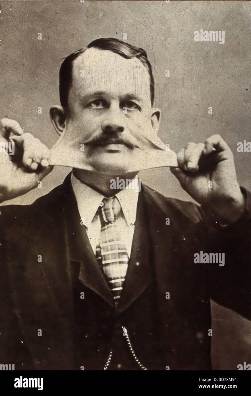James Morris, dehnt die Haut auf seinem Gesicht aus. Kann seine eigene Haut bis zu 46 Zentimeter von seinem Körper aus dehnen, ohne Schmerzen, um die Menschen um ihn herum zu amüsieren. 1882 schloss er sich P.T. Barnum’s Zirkus an und tourte mit der Show viele Jahre durch die Vereinigten Staaten und Europa. Es gibt Berichte über ihn, der sein Geschäft erst 1898 ausführte. Um die Wende zum 20. Jahrhundert war Morris vom Radar gefallen, und es ist unbekannt, wie lange er lebte. Stockfoto