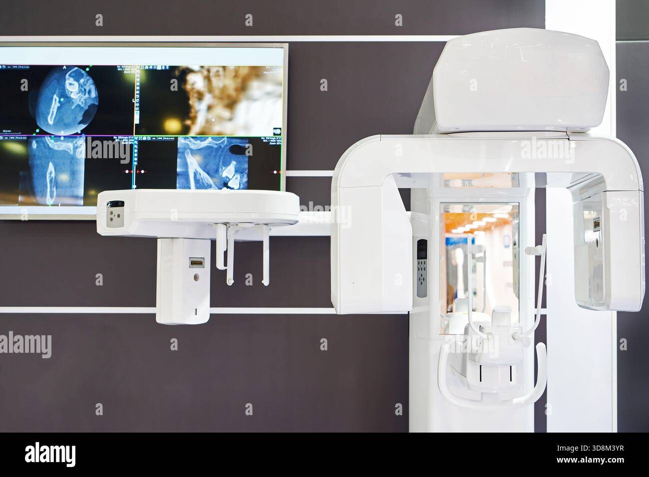 Dentaler 3D-Scanner zur Implantatplatzierung Stockfoto