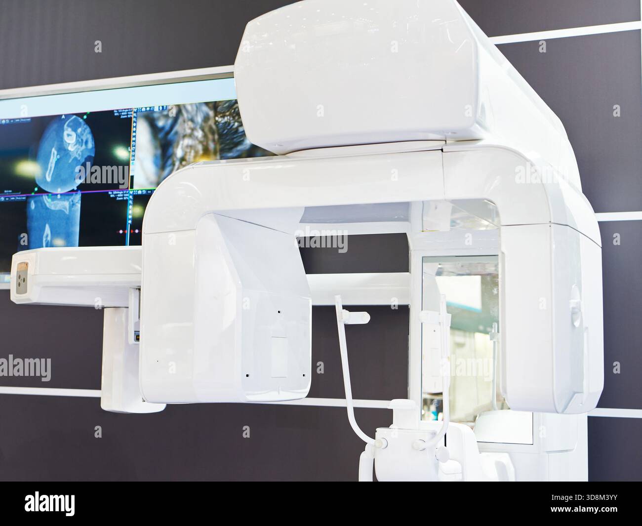 Dentaler 3D-Scanner zur Implantatplatzierung Stockfoto