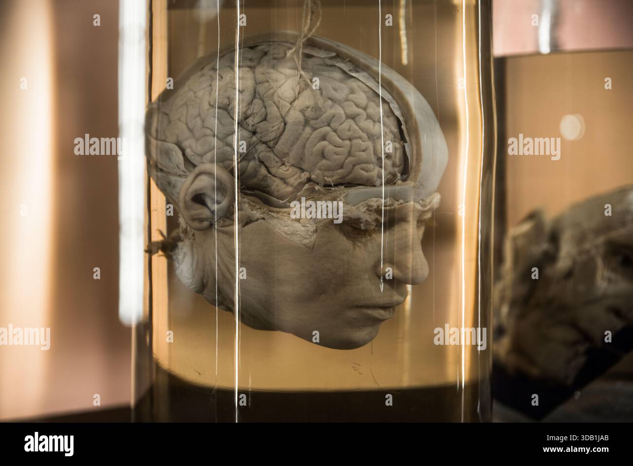 Konserviertes menschliches Gehirn und Kopfstück im Glasgefäß - Anatomische Ausstellung im Museum Neapel Stockfoto