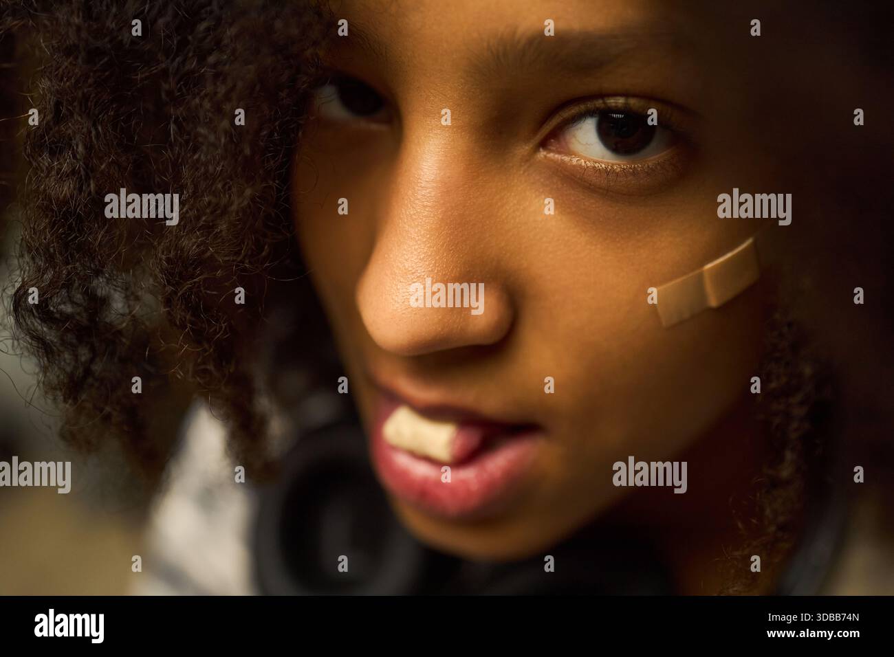 Porträt eines schwarzen Teenagers, der in die Kamera schaut, mit Bandage auf der Wange und einem Stück Mull im Mund, Nahaufnahme des Gesichts mit ausdrucksstarken Augen und natürlichem lockigem Haar Stockfoto