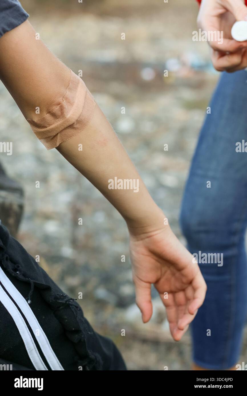 Nahaufnahme von bandagiertem Ellenbogen am Arm, Handpflaster, Schutt auf Kiesboden, Erholungs- und Pflegekonzept. Stockfoto
