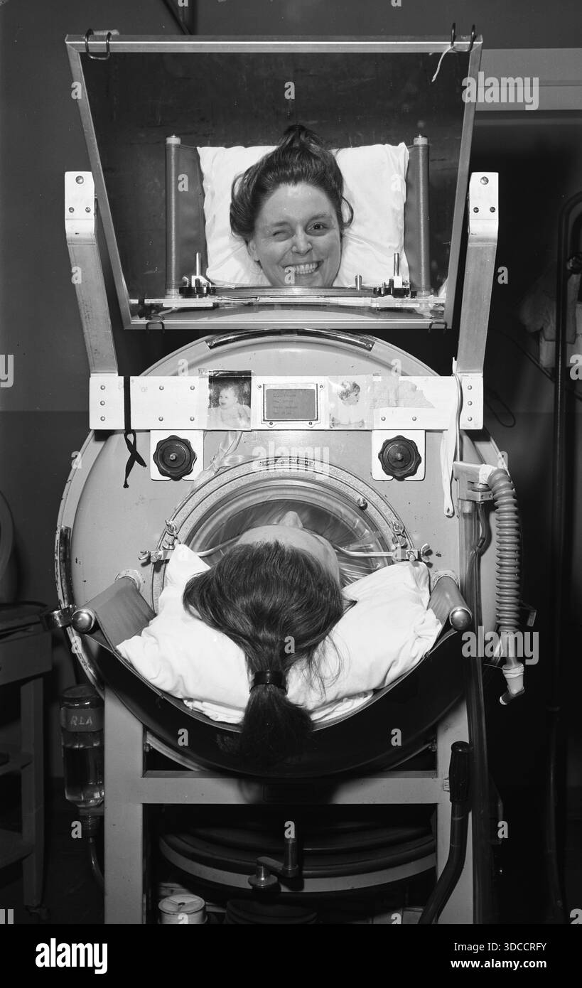 Eine gelähmte Frau lächelt im Spiegel, während sie in einer eisernen Lunge liegt, ca. 1950er Jahre Stockfoto