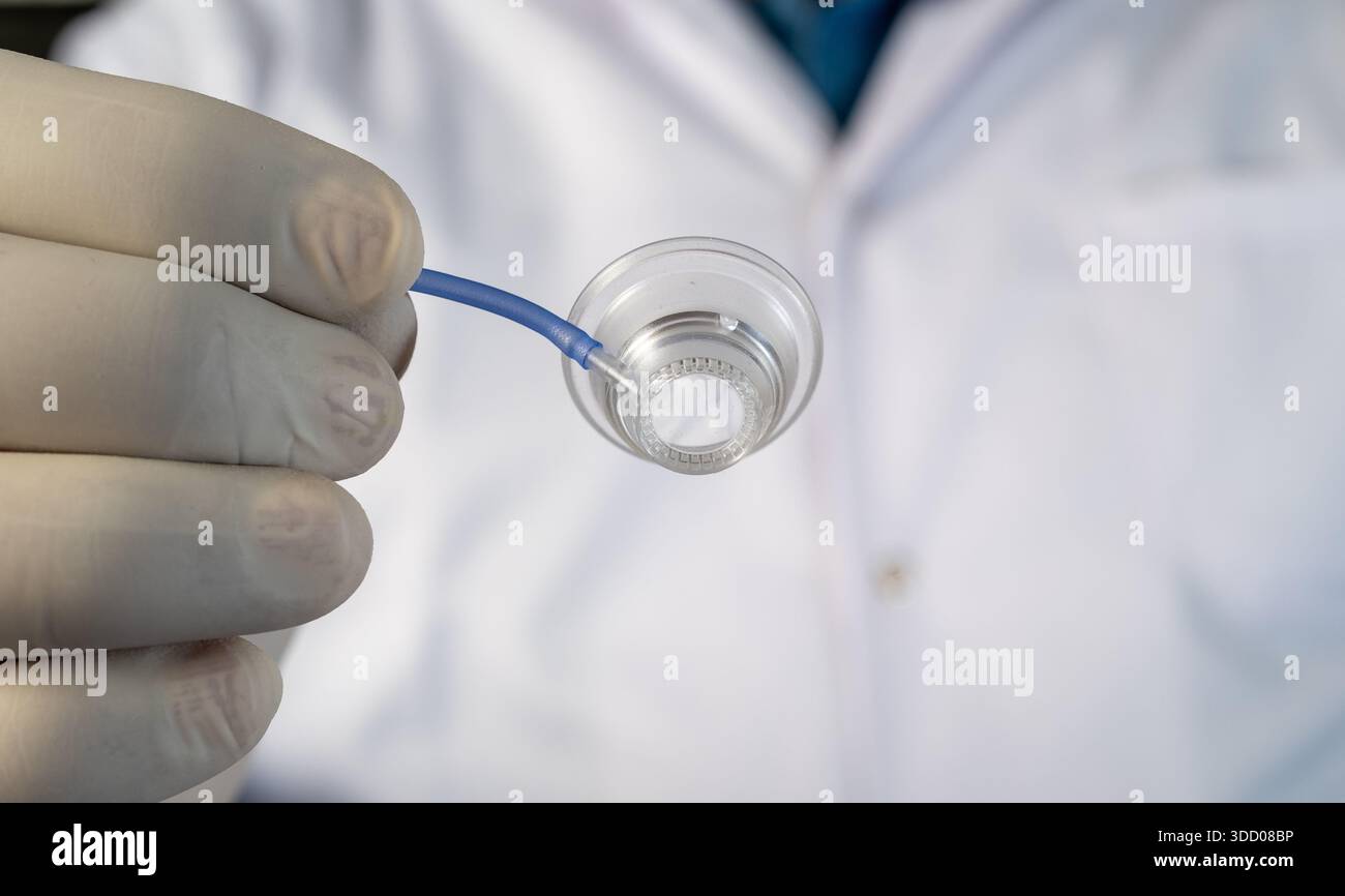 Medizinisches Fachpersonal zeigt VisuMax Behandlungsbecher für refraktive Sehkorrektur Stockfoto
