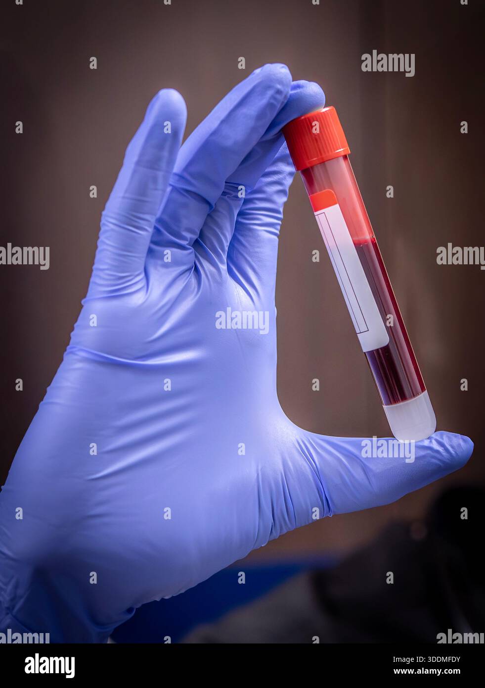 Der Arzt hält eine Durchstechflasche mit Blut Stockfoto