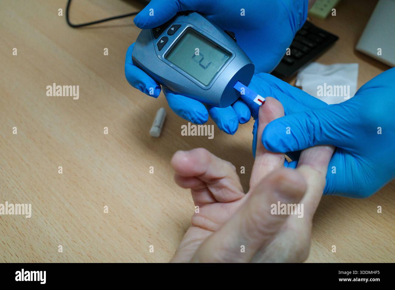 Die Ergebnisse des Glukosetests kommen. Stockfoto