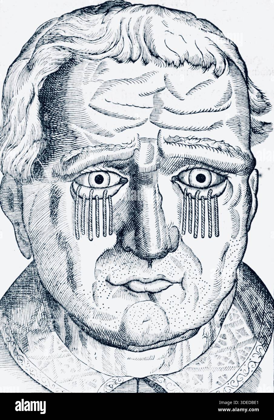 Georg Bartisch (1535–1607) Deutscher Arzt - Bilder aus Bildern aus Ophthalmodouleia: Dies ist, Augenpflege - (Ophthalmodouleia: Das ist, Augendienst) - Platte 183 - 1583 Stockfoto