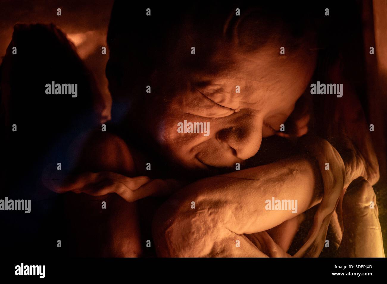 Formalin konservierte späte Fetalprobe für medizinische Forschung Stockfoto