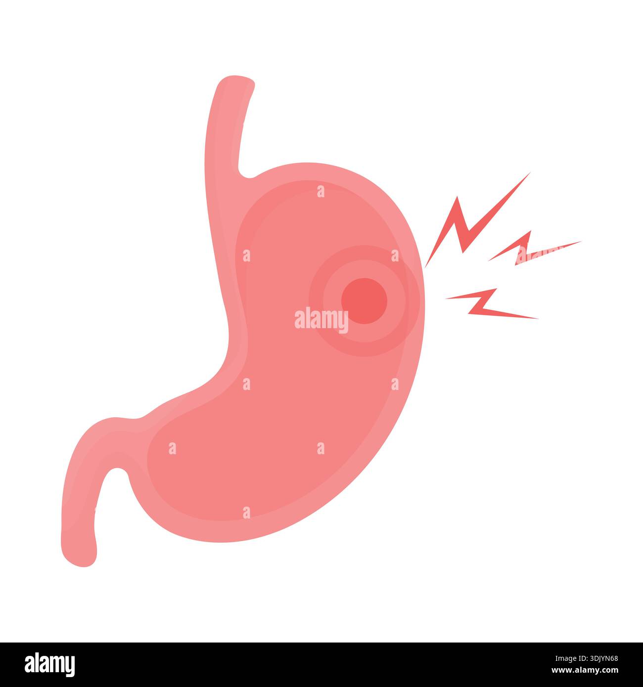 Menschlicher Magen mit Schmerzen. Stock Vektor