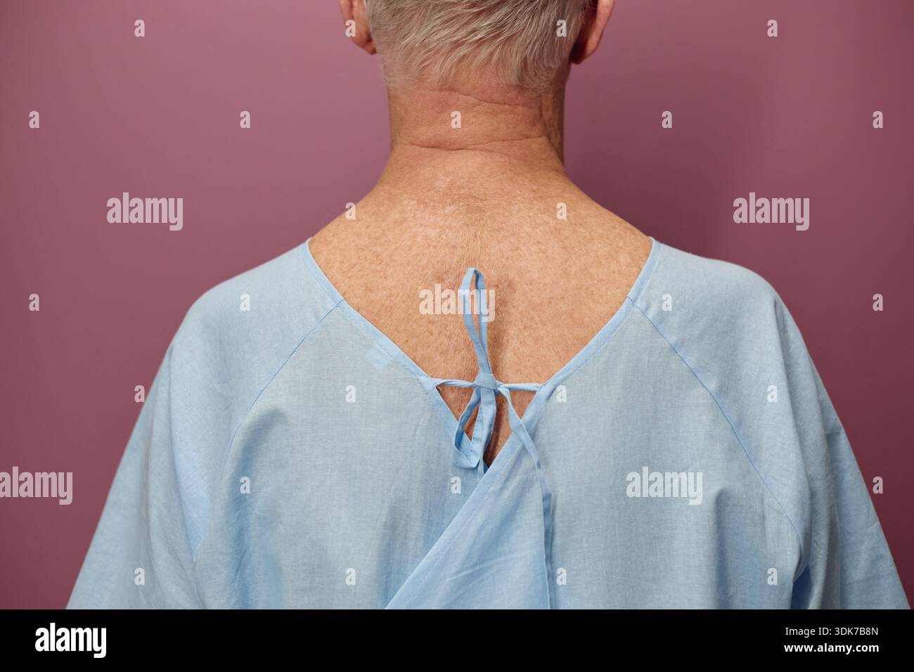 Senior Mann Mit Krankenhauskleid Wartet Auf Eine Gefäßuntersuchung Stockfoto