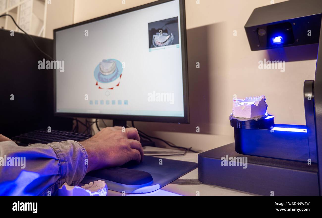 Zahnärztliche Labormitarbeiter scannen Gipsform mit 3D-Scanner für CAD-Modellierung, digitale Prothetik-Konstruktion und kieferorthopädische Planung im zahntechnischen Labor. Stockfoto