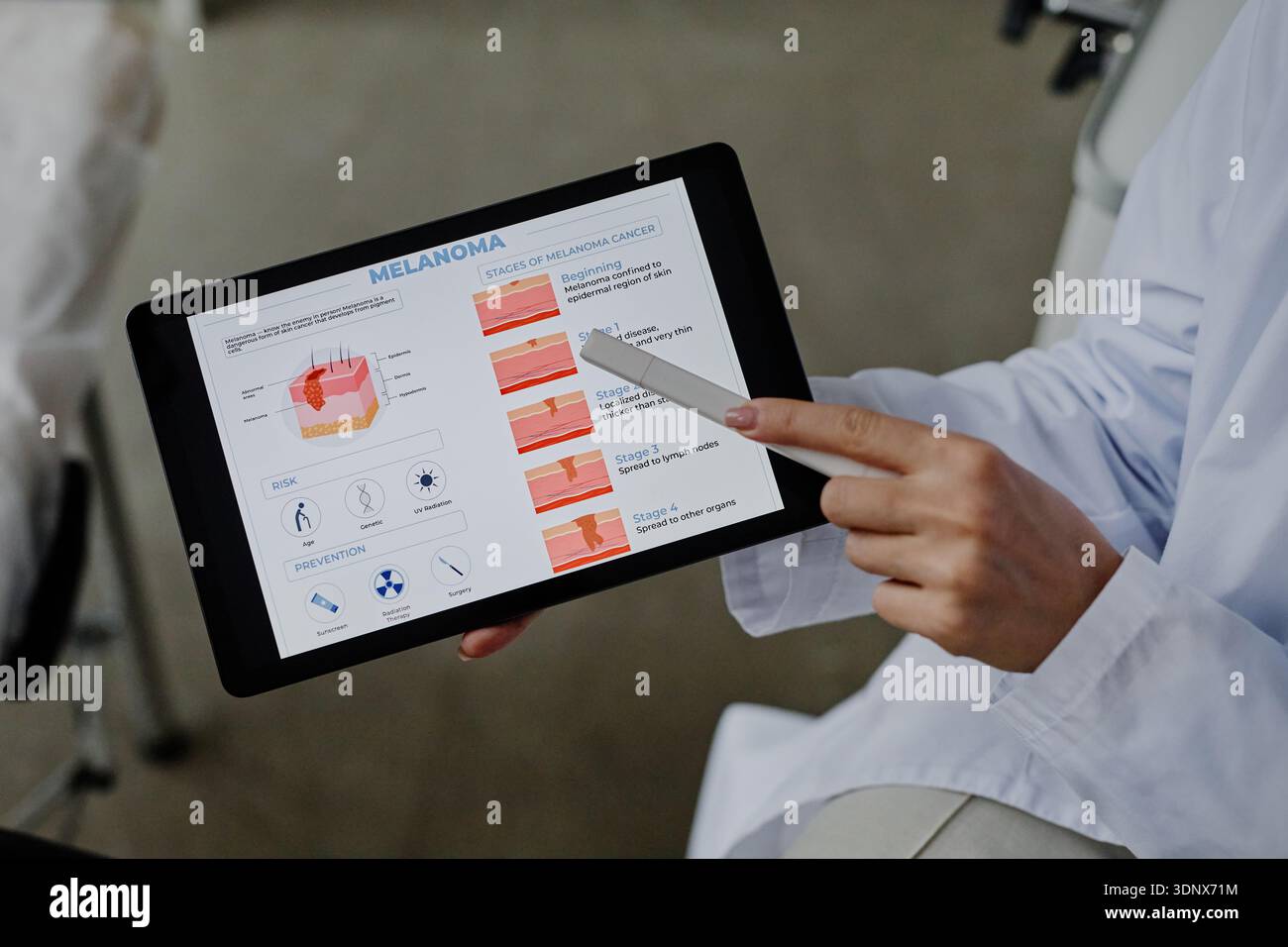 Kaukasische Ärztin Erklärt Melanomstadien Mit Digital Tablet Stockfoto