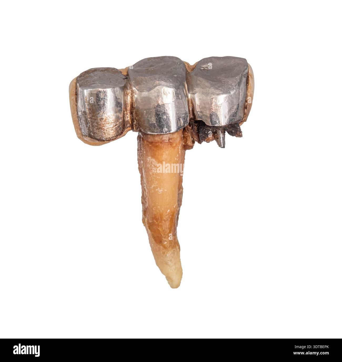Raucherin zähne -Fotos und -Bildmaterial in hoher Auflösung – Alamy