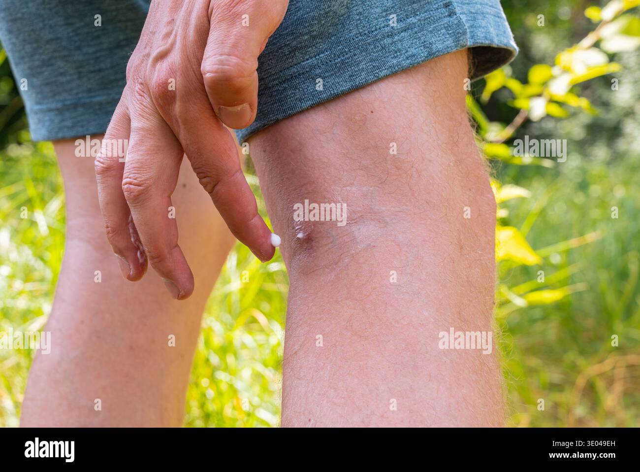 Eine Nahaufnahme zeigt eine Person, die Insektenschutzmittel auf ihre Haut aufträgt. Der Schutz bietet eine Barriere gegen Mücken und Insekten während der Enj Stockfoto