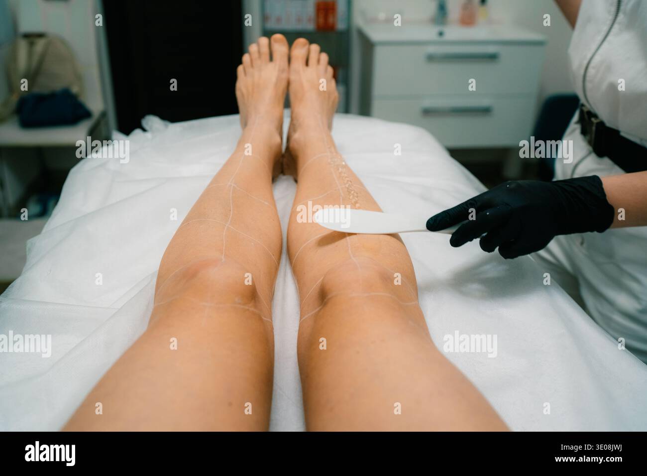 Laser-Haarentfernungssitzung für Beine in einem modernen Klinikumfeld mit fachkundiger Behandlung Stockfoto