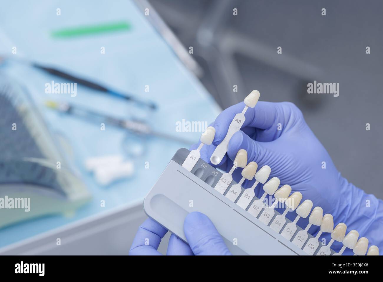 Nahaufnahme von Handschuhen, die Zahnfarbführung vor dem Aufhellungsverfahren in der modernen Klinik halten. Konzept der kosmetischen Zahnheilkunde, sm Stockfoto