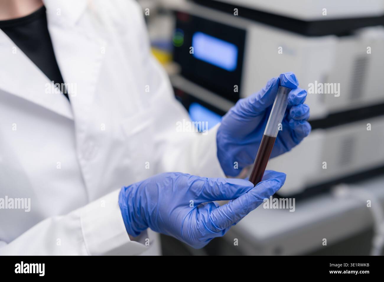 Labortechniker, der die in einem Reagenzglas enthaltene Blutprobe am klinischen Arbeitsplatz inspiziert. Saubere Umgebung mit fortschrittlichen Diagnosegeräten und digitalen Displays, die im Hintergrund sichtbar sind. Stockfoto