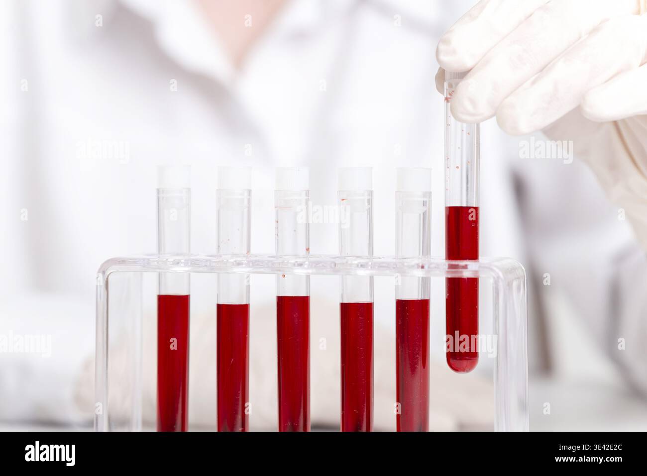 Nahaufnahme der mit Handschuhen versehenen Hand, die Blutprobe in das Reagenzglasgestell, Labordiagnostik und klinischer Testprozess einlegen Stockfoto