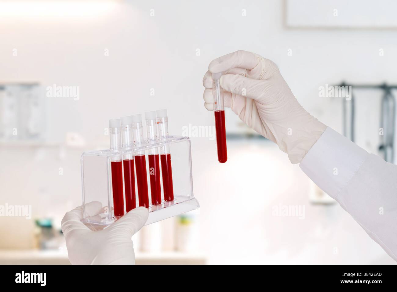 Hände mit Handschuhen, die Blutproben in Rack und Reagenzglas halten, Labor-Workflow und klinisches Analysenkonzept Stockfoto